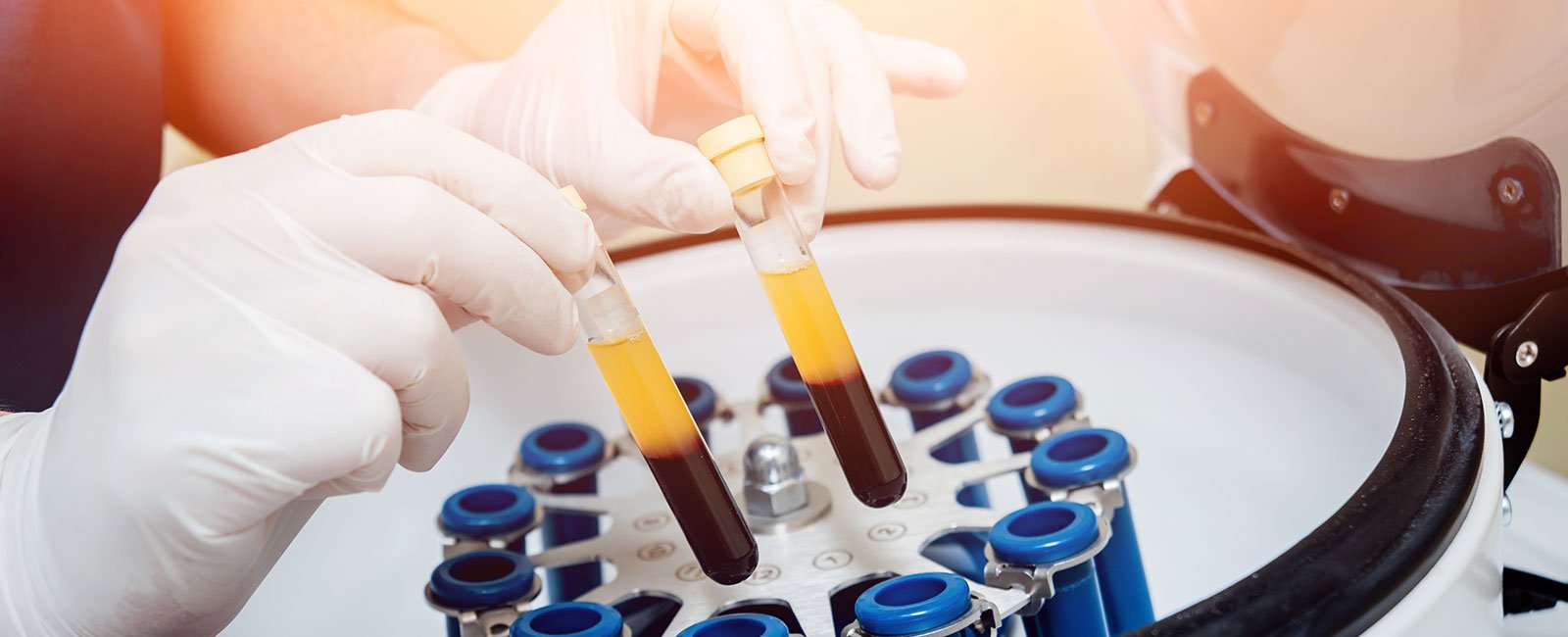 Gloved hands hold two yellow plasma test tubes above a centrifuge with multiple test tubes.
